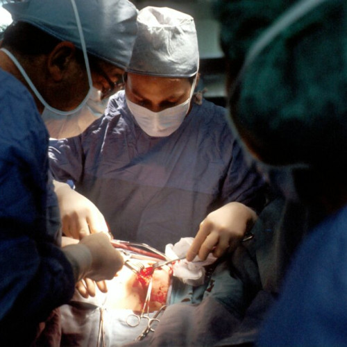 Bunicul diagnosticat cu cancer bronhopulmonar: necesitatea chimioterapiei