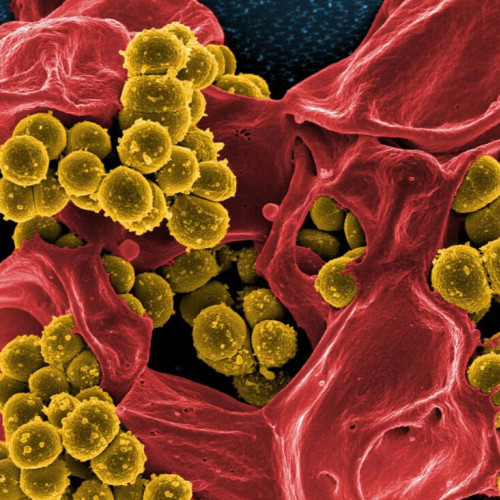 Spitalele, un factor important în răspândirea infecțiilor rezistente la antibiotice