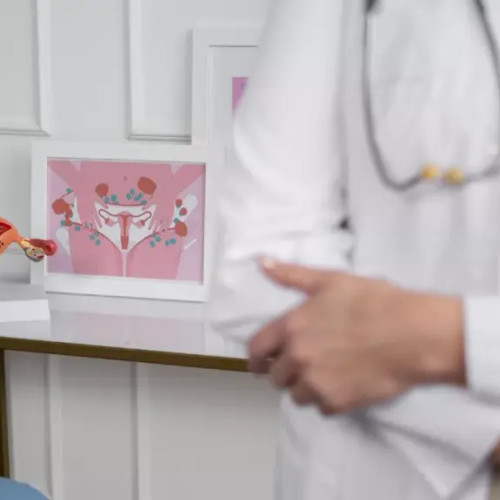 Mama diagnosticată cu polipi uterini, tratament și îngrijorări