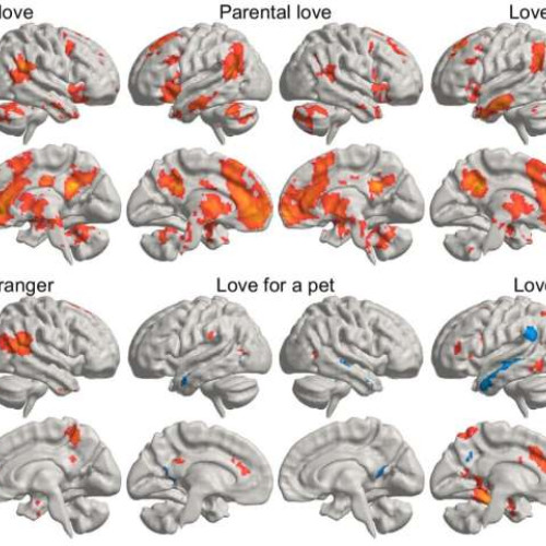 Cercetătorii finlandezi descoperă activitatea creierului asociată cu diferitele forme de dragoste