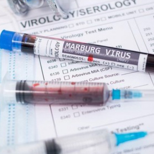 Rwanda înregistrează noi cazuri de infectare cu virusul Marburg