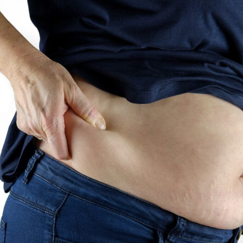 Abdominoplastia: Răspunsuri pentru mămicile care doresc să recapete forma abdominală