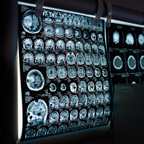 Tudor și Smaranda Gramada, medici radiologi dedicati la Institutul Regional de Oncologie