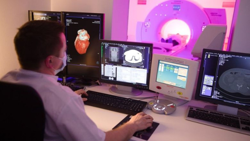 Ateromatoza: o afecțiune tăcută care poate provoca accidente vasculare cerebrale