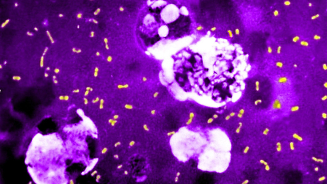 O bacterie microscopică a influențat de trei ori istoria omenirii, provocând pandemii mortale și victime înzecite, relatează digi24.ro. Potrivit cercetătorilor, un "truc genetic" surprinzător explică modul în care microbul care provoacă ciuma, yersinia pestis, a reușit să supraviețuiască timp de sute de ani. Astfel, bacteria și-a redus gradul de virulență în mod paradoxal, pentru a putea infecta mai mult, dar pe o perioadă mai lungă, notează El Pais.