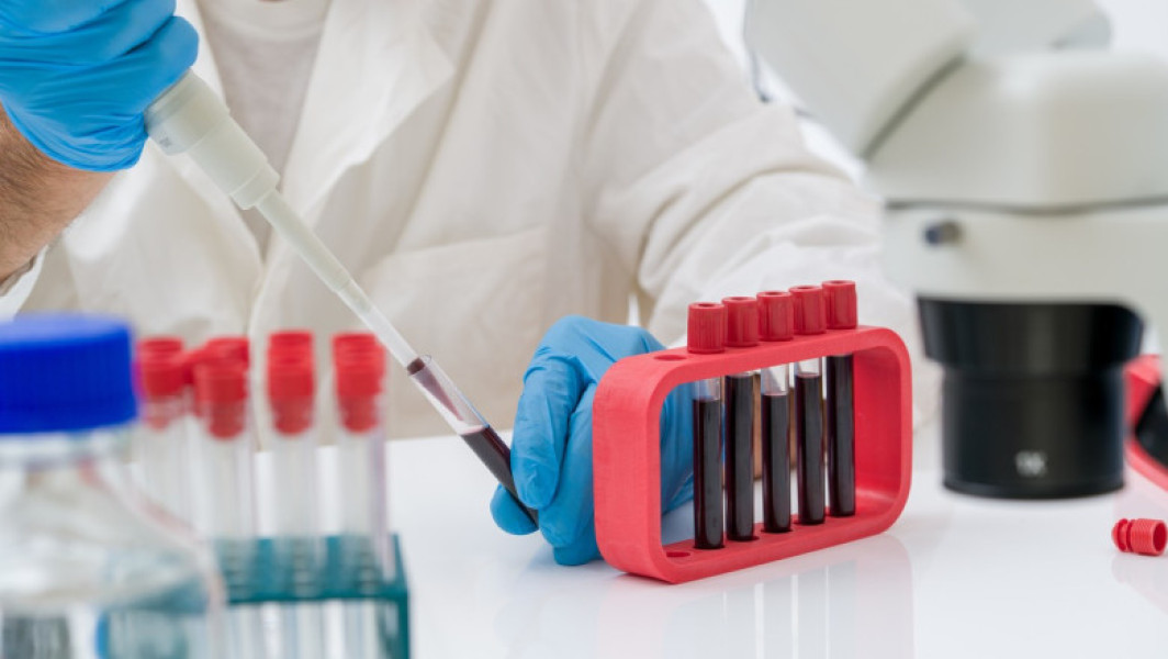 cercetare promițătoare pentru detectarea timpurie a cancerului bazată pe analiza plasmei sanguine