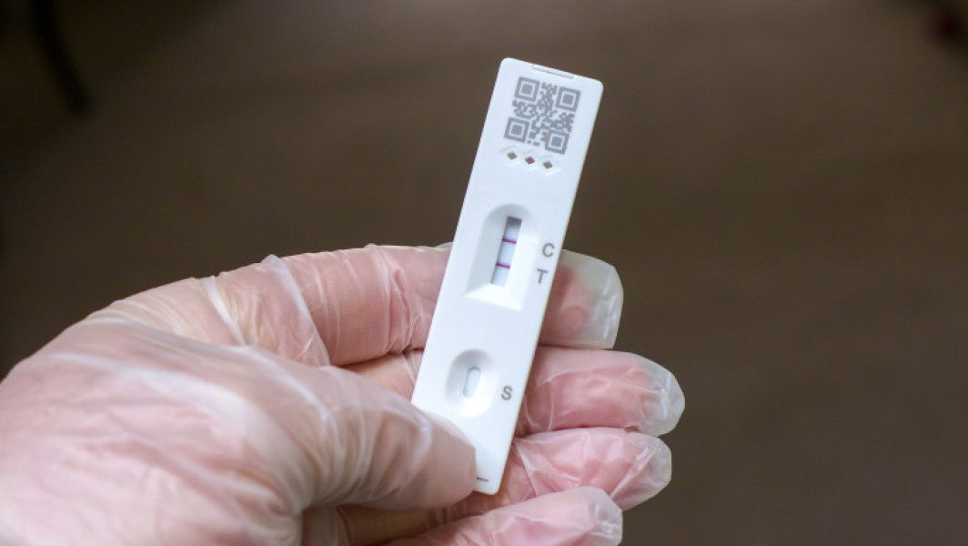 testele de saliva, o metoda moderna de diagnostic non-invaziv