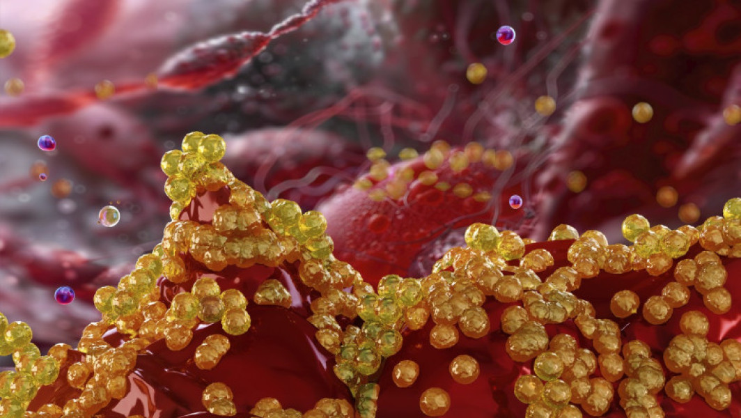 Rezistența antimicrobiană ar putea provoca moartea a milioane de oameni și pierderi economice uriașe până în 2050