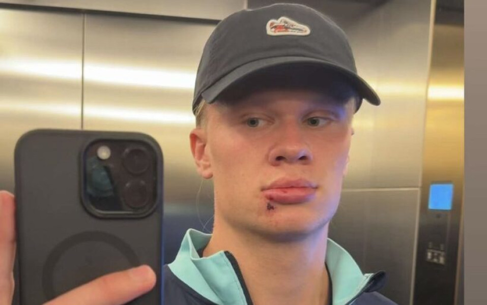 Erling Haaland, victima unui incident la cantonamentul Norvegiei