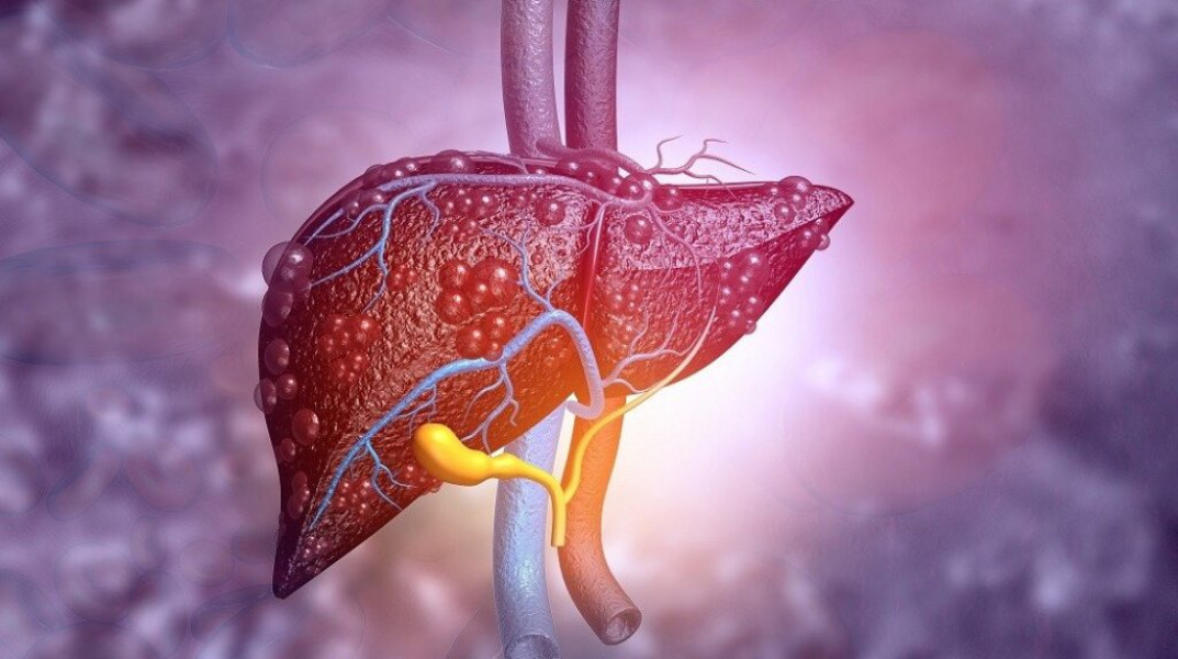 Fibrele vegetale ar putea preveni și inversa boala hepatică legată de metabolism