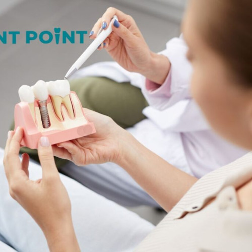 Implantul dentar sau proteza: ce aleg pentru un zâmbet natural și confort