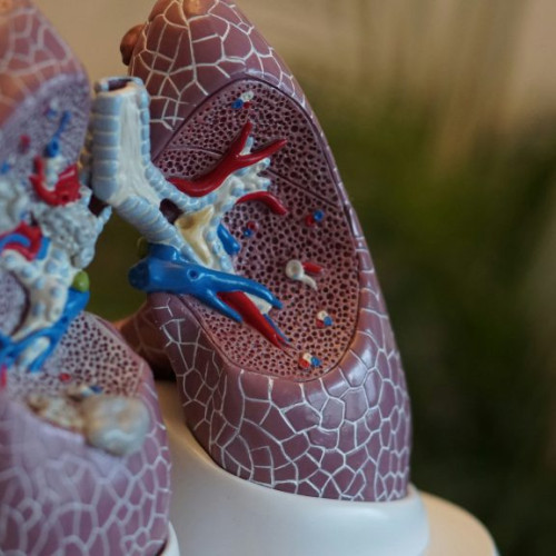 Autoritatea americană aprobă o imunoterapie țintită pentru cancer pulmonar dificil de tratat