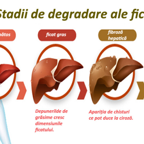 Hepatita autoimună: o afecțiune cronică inflamatorie a ficatului